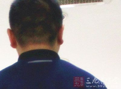 肥胖人群易患“三高”疾病 肥胖人群易患“三高”疾病