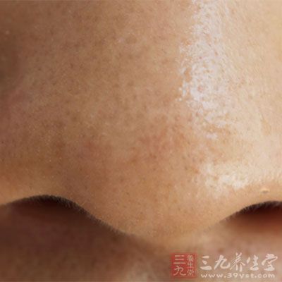 T字部位最容易分泌大量油脂，油油的鼻子、油油的额头需要彻底的清洁，都在时间一长就会形成酒糟鼻。