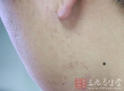 熬夜也会让男人激素水平失调 熬夜也会让男人激素水平失调