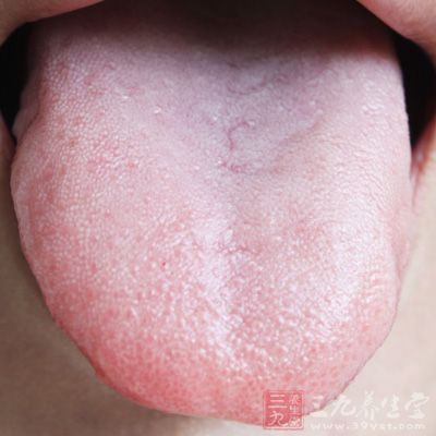 舌苔发白，是阳虚的症状