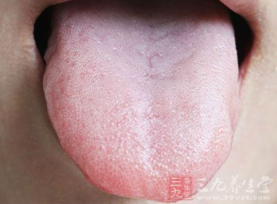 舌头痿软而且舌头的颜色红，那么就是我们的身体热极伤津