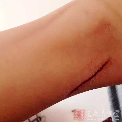 据情可交替使用镇静、解痉药物