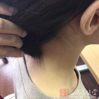 颈前部咽喉位置 颈前部咽喉位置