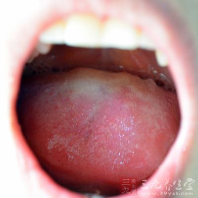 口中的扁桃体对人体并没有太大用处