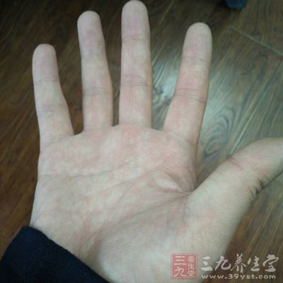 生姜可以減少手腳冰涼