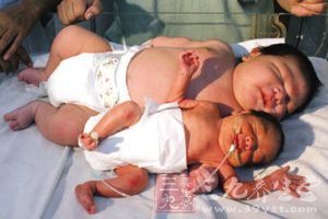 一名刚降临的“超级女婴” 一名刚降临的“超级女婴”