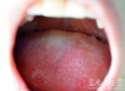 口苦口臭的原因多种多样，不仅仅口腔细菌繁殖造成