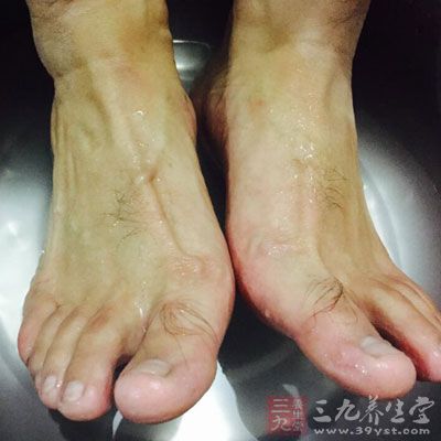 用泻盐和热水的混合溶液浸泡双脚可以暂时缓解疼痛