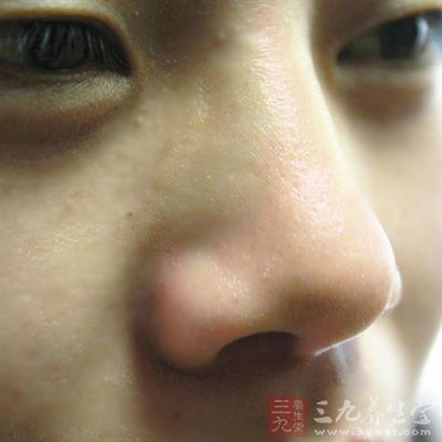 所谓鼻梁起节就是在鼻梁中间有骨头明显凸出