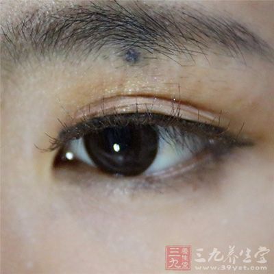 眼压高、青光眼、高血压者或眼睛有红肿热痛时 眼压高、青光眼、高血压者或眼睛有红肿热痛时