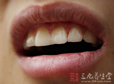 为什么韩国明星们的牙齿那么白