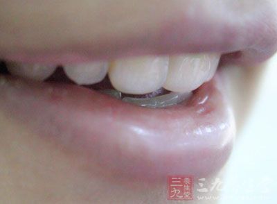 牙齿固定主要是针对外伤引起的牙齿松动