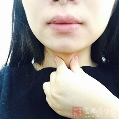 寻常的上呼吸道病毒感染所带来的咽部、扁桃体的发炎 寻常的上呼吸道病毒感染所带来的咽部、扁桃体的发炎