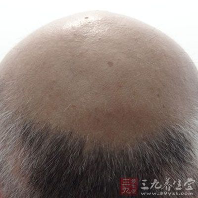 男人是骄傲的动物，然而脱发、口臭是令男人头疼的烦恼