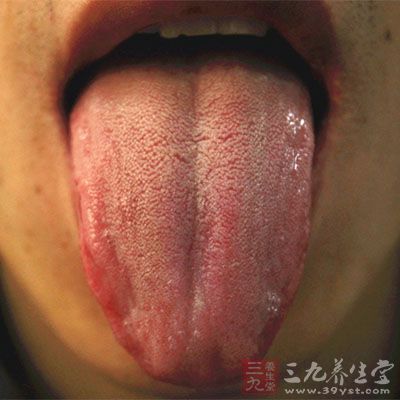 舌干红，苔薄黄或花剥