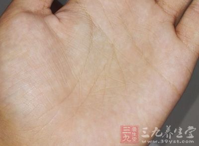 鹅掌风