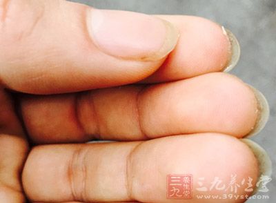指甲上的尘垢就是一种最大的致病因素