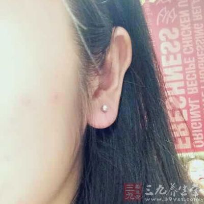 外耳道是一条自外耳门至鼓膜的弯曲管道 外耳道是一条自外耳门至鼓膜的弯曲管道