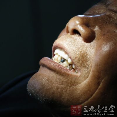 对牙齿本身不好 对牙齿本身不好