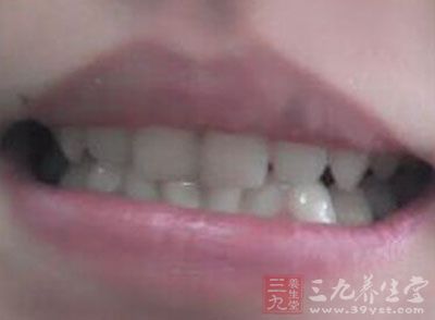 随着龋齿发病人群的逐渐“庞大