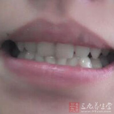 维生素泡腾片可造成牙齿矿物质流失