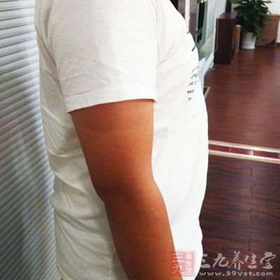 藏不住腹部赘肉 藏不住腹部赘肉