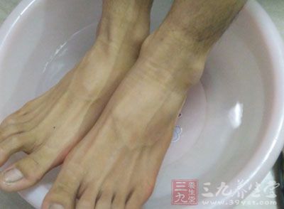 腳氣怎么根治 夏季怎么遠離腳氣