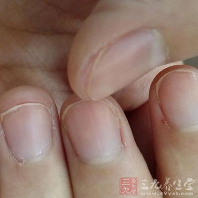 指甲变脆、分层断裂，生长缓慢