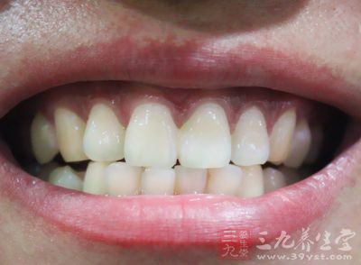 牙缝过大解决之道 牙缝过大解决之道