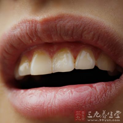 解决牙缝过大的问题,可以采取矫正 解决牙缝过大的问题,可以采取矫正