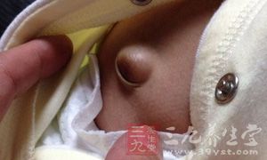 一个好肚脐应该是三个标准 一个好肚脐应该是三个标准