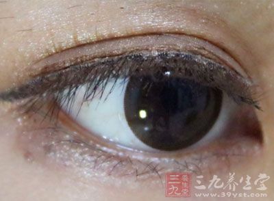 眼内血丝漫布,眨眼时仿佛感觉眼皮缺少润滑 眼内血丝漫布,眨眼时仿佛感觉眼皮缺少润滑