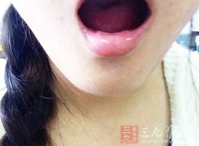 唾液腺功能降低 唾液腺功能降低