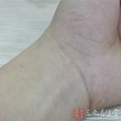 易使手腕部股肉慢性勞損