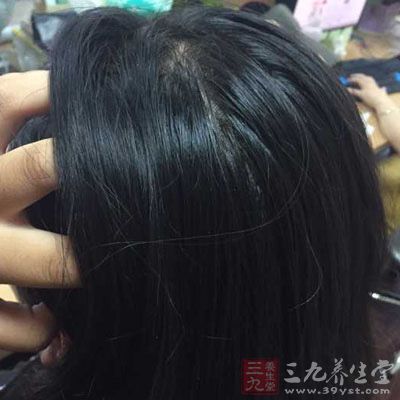 过敏症在冬季反而会更为明显 过敏症在冬季反而会更为明显