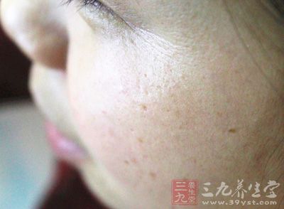 皱纹就早早地来和你 “见面 ”了 皱纹就早早地来和你 “见面 ”了