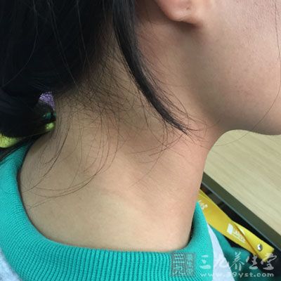 在所有的甲状腺结节中,90%以上是低度恶性的