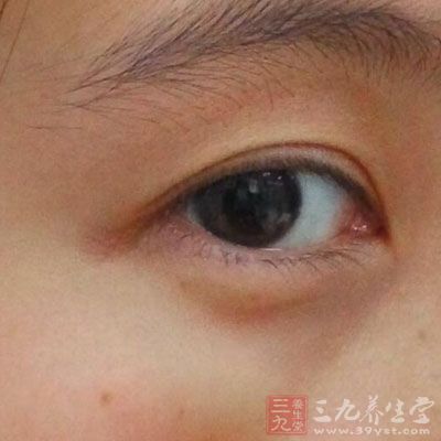 以下瞼內(nèi)眥部為好發(fā)部位