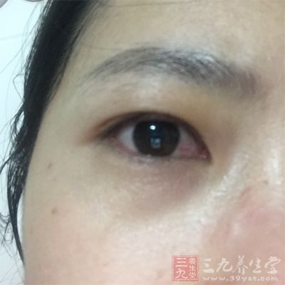 女性经期保护好眼睛