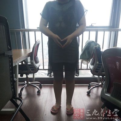 病态性水肿”是由疾病造成的，例如妊娠毒血症