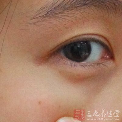 初起有眼睑痒、痛、胀等不适感觉