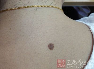 人的头颈处经脉网罗密布,穴位庞杂 人的头颈处经脉网罗密布,穴位庞杂