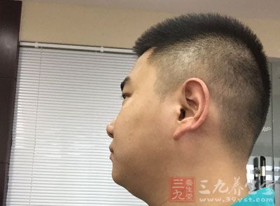 哪些食物会使皮肤变黑