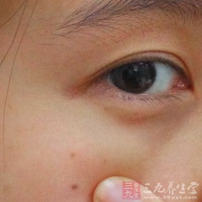 常僅出現(xiàn)于一眼，可發(fā)生于任何年齡組