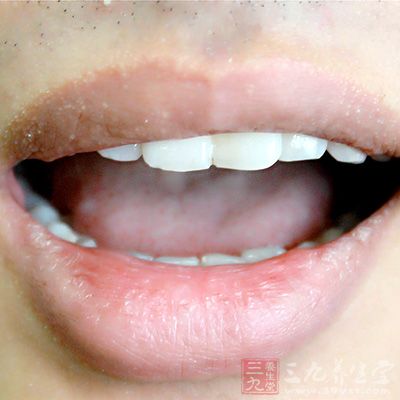 有持久的口臭 有持久的口臭