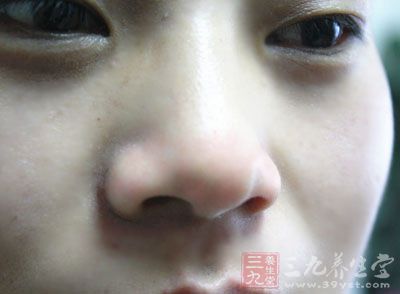 两手拇指擦热,揩擦鼻头36次 两手拇指擦热,揩擦鼻头36次