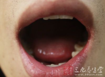 中医对“舌诊”的研究由来已久 中医对“舌诊”的研究由来已久