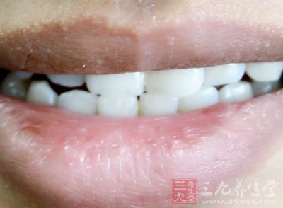 拥有一口洁白健康的牙齿,笑起来会显得特别迷人 拥有一口洁白健康的牙齿,笑起来会显得特别迷人