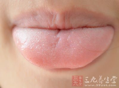 舌苔厚又腻 饮食要清淡