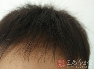 “头为诸阳之首”,也就是所有阳气汇聚的地方 “头为诸阳之首”,也就是所有阳气汇聚的地方